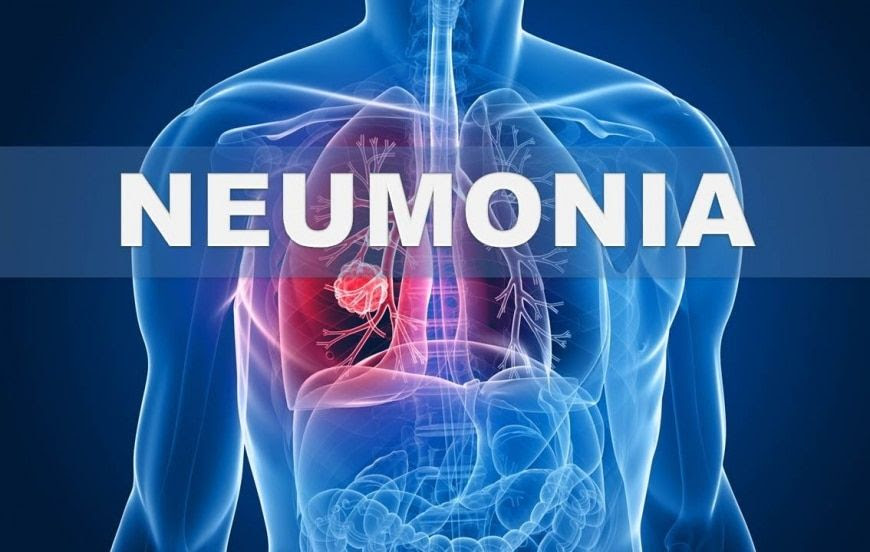 Risk Factors Associated With Nosocomial Pneumonia In Adult Patients Revista De La Facultad De